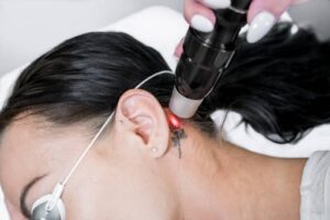 tattoo removal from laser